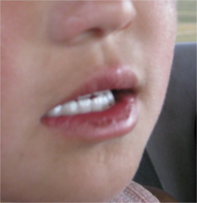 Mongolians have finer teeth than anywhere else I've been. This dawned on me after being there over a week. A Mongolian woman told me she thought it was because of all the calcium they eat from dairy. I'm sure that's a large part of it, but they must also be genetically predisposed to having such straight, nicely formed chompers! Seriously, who would have thought Mongolians would have such fantastic teeth?!